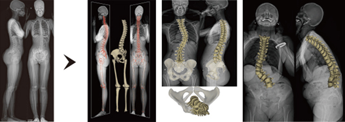 x-ray 이미지