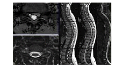 Снимки позвоночника(Spine Image)