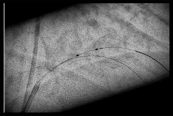 혈관 강조 영상(Magnetic Resonance Angiogram) 이미지