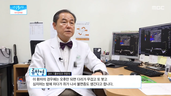 혈액의 역류로 발생하는 하지정맥류의 증상과 치료 이미지